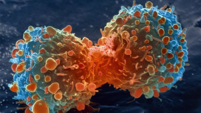 Cientistas identificam quantas mutações geram cada tipo de câncer